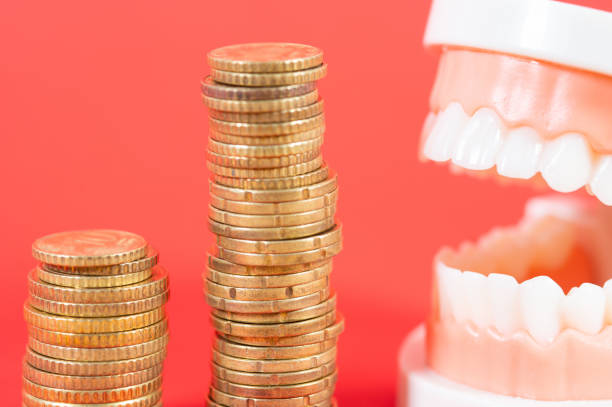 All-On-4 Dental Implants Financing